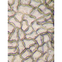 0301_rastlina_celice.jpg<>Celice listne povrhnjice (svetlobni mikroskop; 100-kratna povečava).
