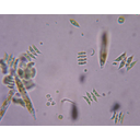 Green_algae.jpg<>Celice zelenih alg pod mikroskopom